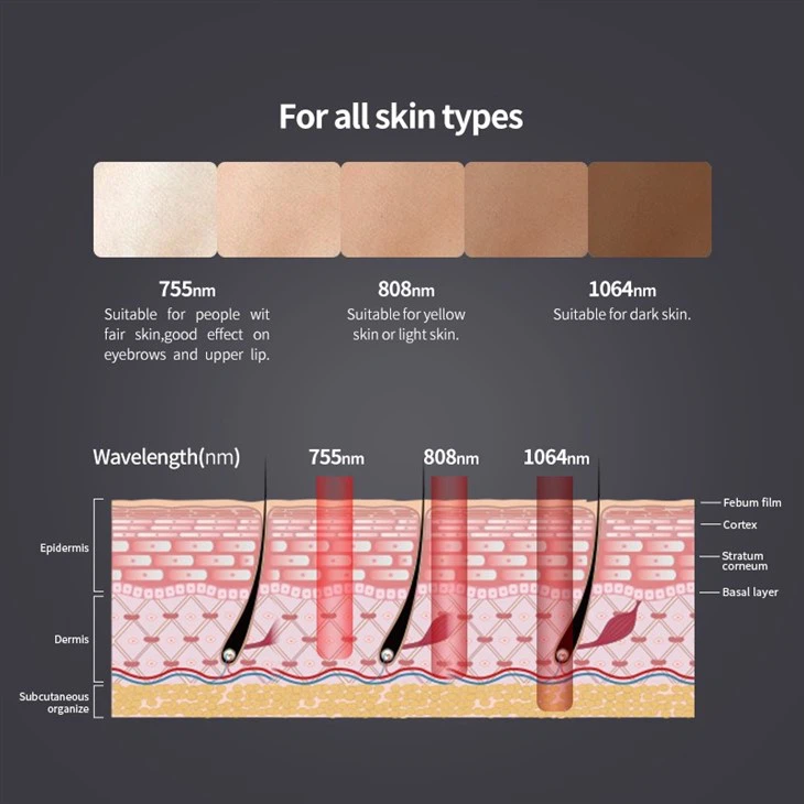The Best Diode Laser Hair Removal
