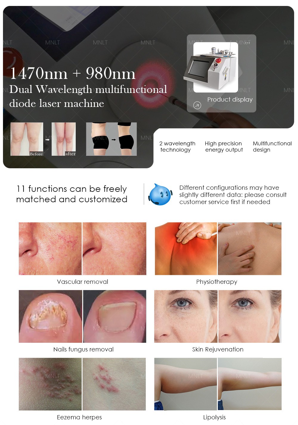 9801470-10 9801470-10